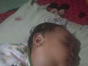 PEDULI DILAN ZAURI : TUMOR SEMAKIN MEMBESAR, ORANG TUA CUMA BERHARAP KEPEDULIAN PEMERINTAH